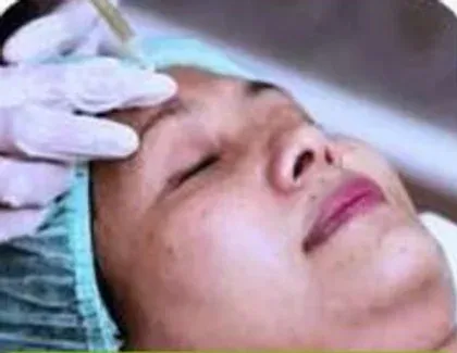Injeksi & Skin Booster